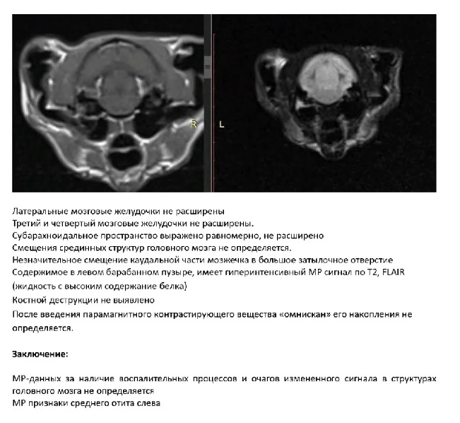 Отит среднего уха